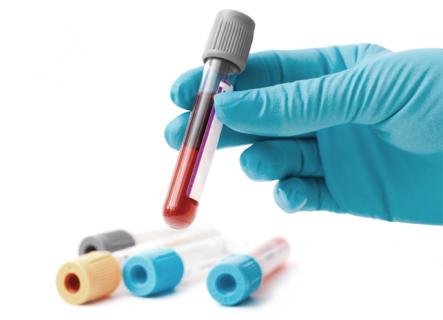 laboratory-testing-of-anticoagulants